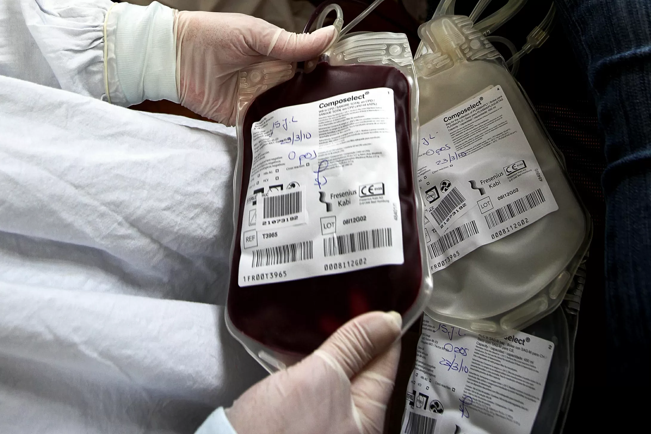 Alargamento da idade dos dadores de sangue pode ajudar nas quebras afirma Federação