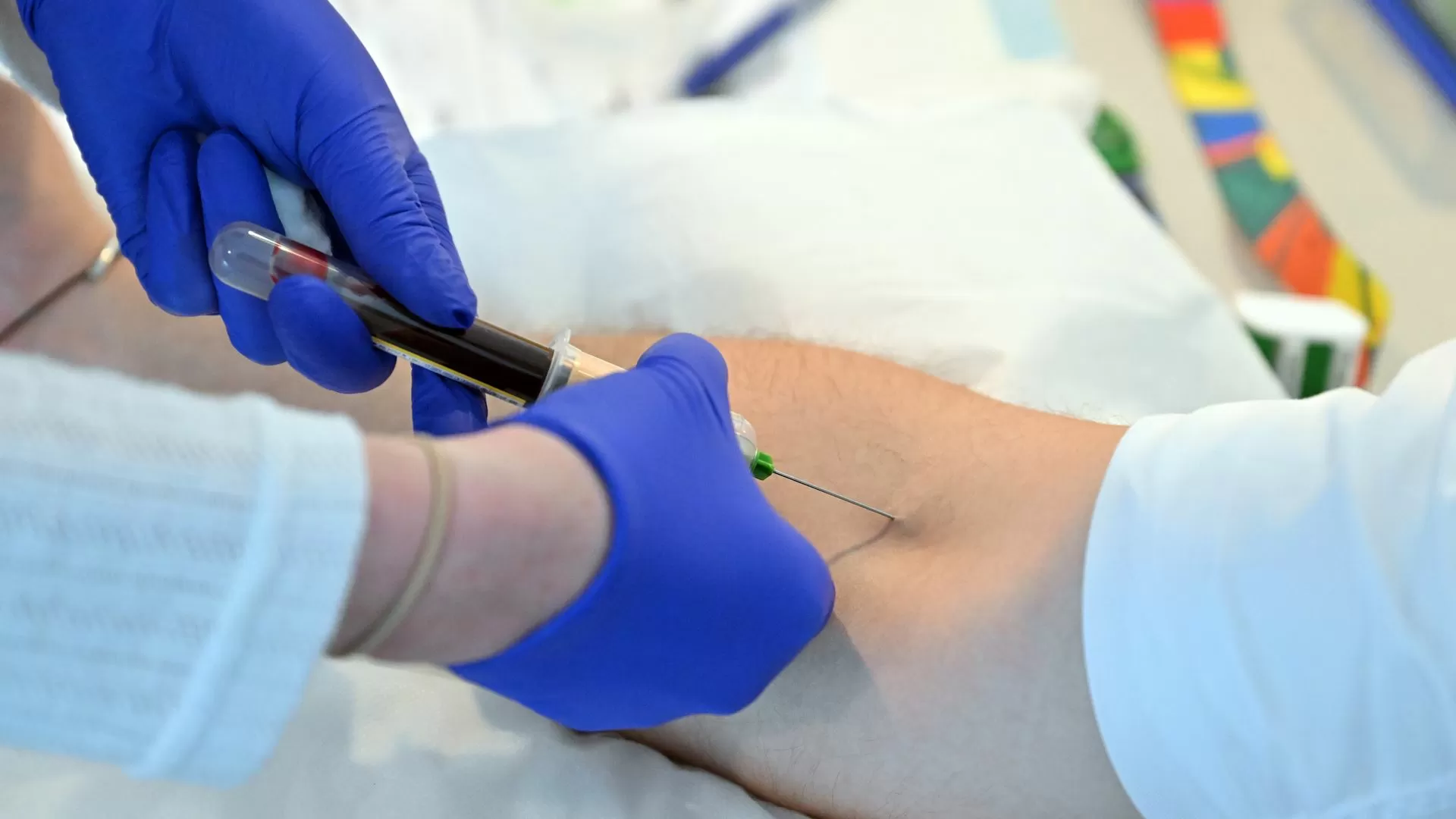 Daltónicos podem ter menor taxa de sobrevivência no cancro da bexiga