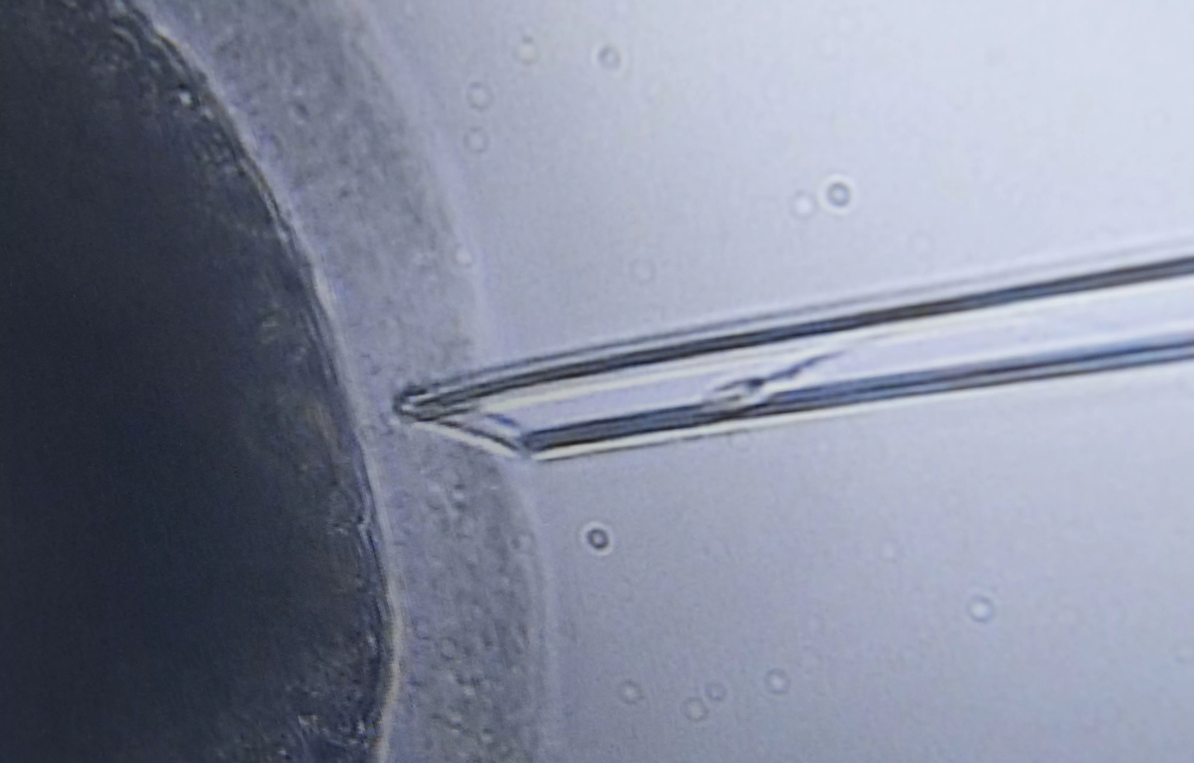 Ordem dos Biólogos alerta para riscos da inseminação caseira