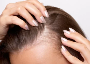 Especialista recomenda cinco alimentos para combater a queda de cabelo