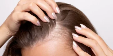 Especialista recomenda cinco alimentos para combater a queda de cabelo