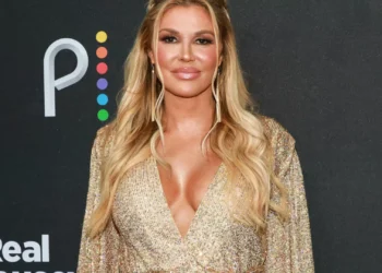 Estrela de ‘Real Housewives of Beverly Hills’ alega ter parasita na cara