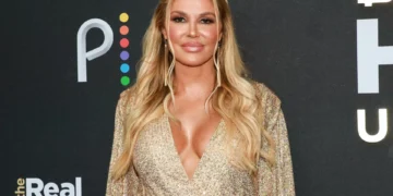 Estrela de ‘Real Housewives of Beverly Hills’ alega ter parasita na cara