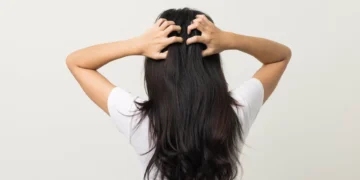 Comichão no couro cabeludo? O que uma dermatologista quer que saiba