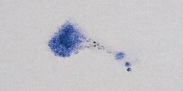 Sim, é possível eliminar riscos de caneta com laca. Respire fundo!