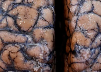 Identificadas zonas do cérebro necessárias para memorizar palavras
