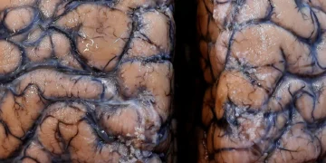 Identificadas zonas do cérebro necessárias para memorizar palavras