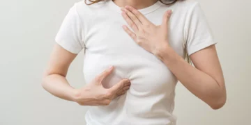 As dicas de um gastroenterologista para acabar com o refluxo