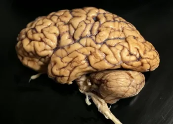 Autorizado fármaco para atrasar deficit cognitivo em doentes com Alzheimer