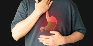 Refluxo esofágico. O que deve fazer durante uma crise