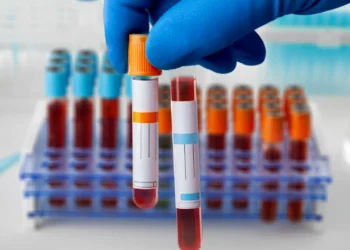 Cancro do estômago: Tipo de sangue pode ser fator de risco