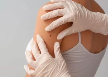 Cancro da pele: A importância da prevenção e os mitos associados à doença