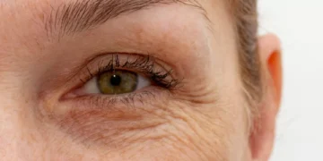 Envelhecimento: A razão pela qual a sua pele enruga com o passar dos anos