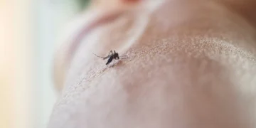 O que fazer depois de ser picado por um mosquito (e que muitos ignoram)