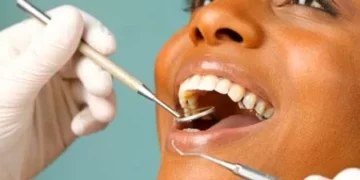 Odontoprev: lucro líquido soma R$ 128,7 milhões no 3T, queda de 9,2% anualmente