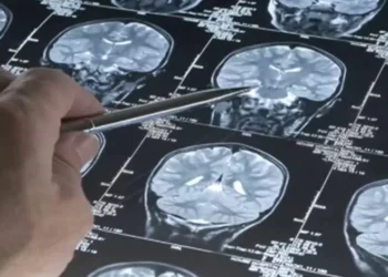 ​Adolescência prolonga-se até aos 30 anos, conclui novo estudo sobre o cérebro