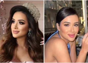 Os gastos de candidata ao ‘BBB 26’ só com procedimentos estéticos