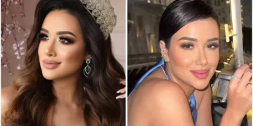 Os gastos de candidata ao ‘BBB 26’ só com procedimentos estéticos