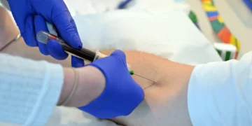 Daltónicos podem ter menor taxa de sobrevivência no cancro da bexiga